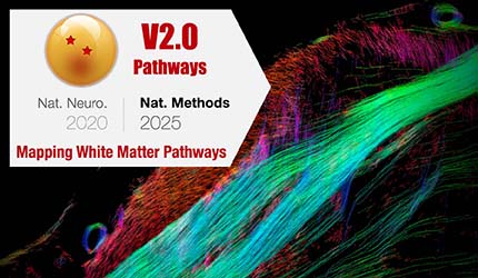 刘赐融组合作开发细胞尺度全脑纤维重建新技术