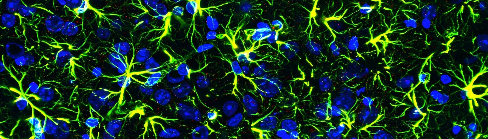 脑智卓越中心成功绘制大脑星形胶质细胞转录因子功能图谱