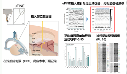 脑智卓越中心合作发表人类大脑皮层大规模单神经元记录最新研究成果