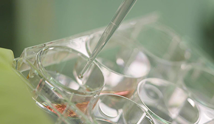 喜报丨脑智卓越中心“帕金森病的细胞治疗药物研发”荣获第四届上海职工优秀创新成果奖二等奖